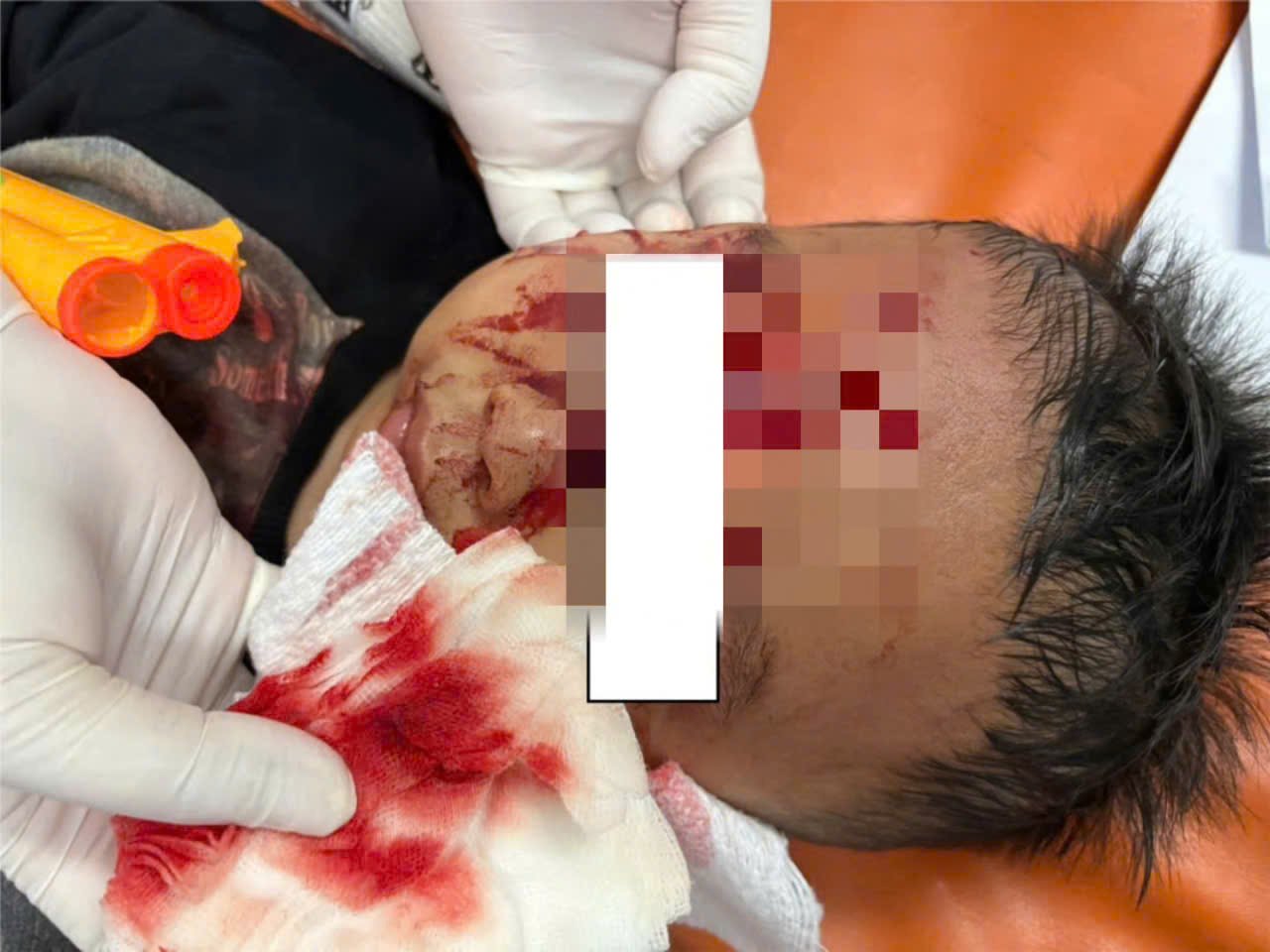 ចំណងជើងរូបថត