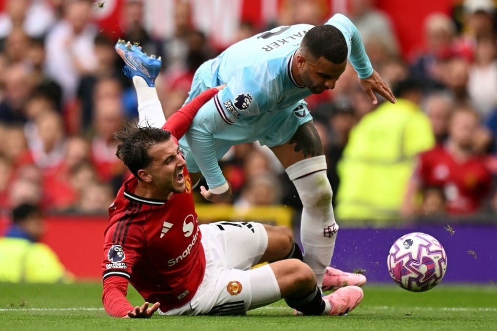 Man Utd nhận tổn thất lớn trước màn so tài với Man City - 2