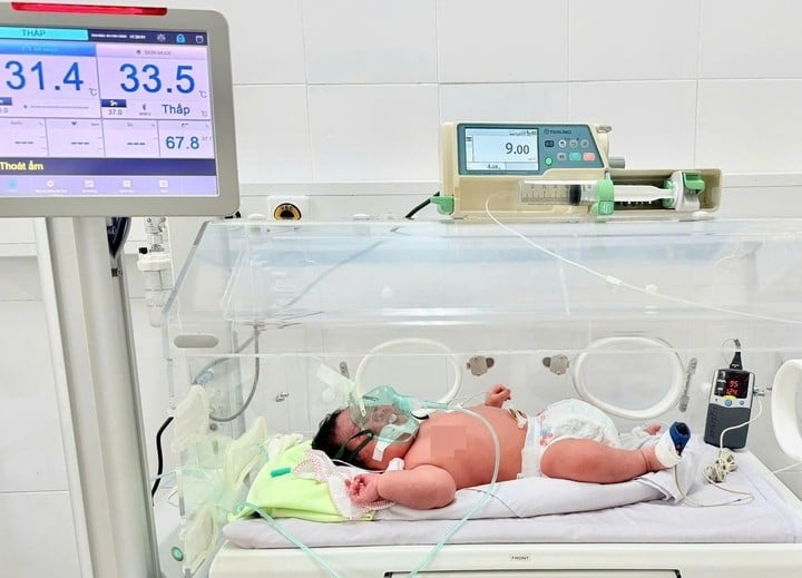 Το μωρό γεννήθηκε με βάρος 6,2 κιλά.
