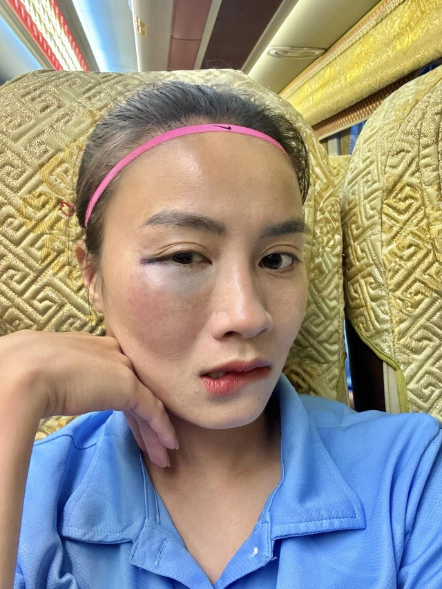 'Hot girl' របស់​ក្រុម​នារី​វៀតណាម​ចែក​រំលែក​មុខ​របួស​ពី​ការ​ប្រកួត​ធ្វើ​ឱ្យ​អ្នក​គាំទ្រ​ខូច​ចិត្ត - រូបថត ១.