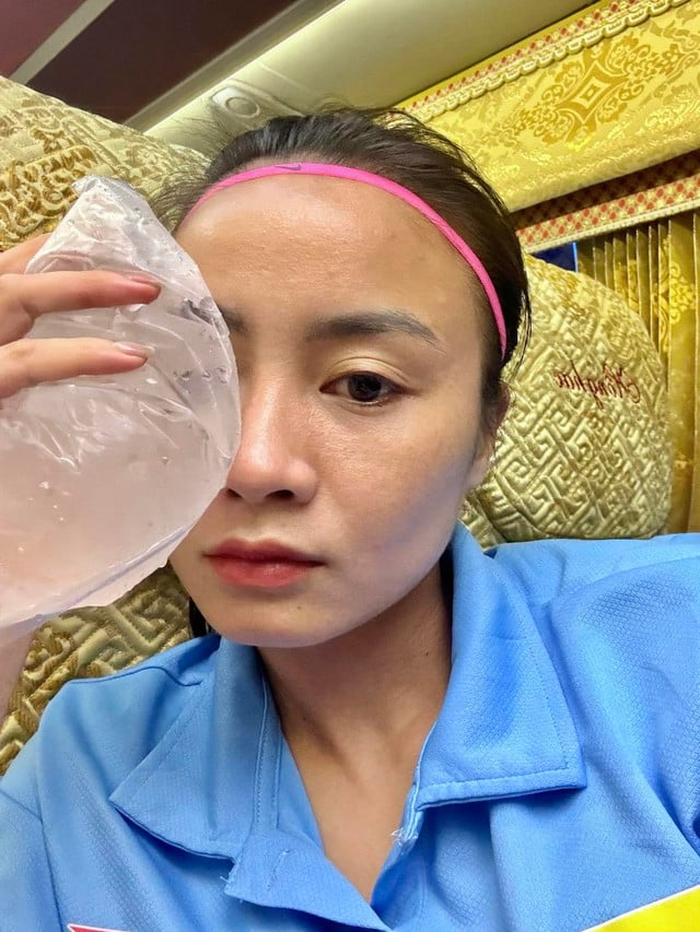 'Hot girl' របស់​ក្រុម​នារី​វៀត​ណាម​ចែក​រំលែក​មុខ​របួស​ពី​ការ​ប្រកួត​ធ្វើ​ឱ្យ​អ្នក​គាំទ្រ​ខូច​ចិត្ត - រូបថត 2.