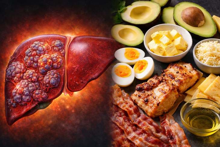 keto - Ảnh 1.