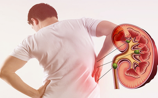 7 tác nhân âm thầm gây tổn thương thận không nên bỏ qua