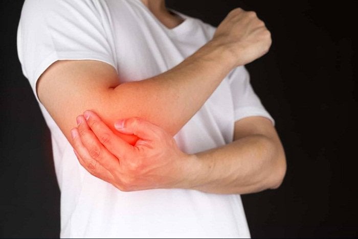Come trattare la rigidità del gomito? - Immagine 1. Cứng khớp khuỷu tay chữa cách nào?- Ảnh 1.