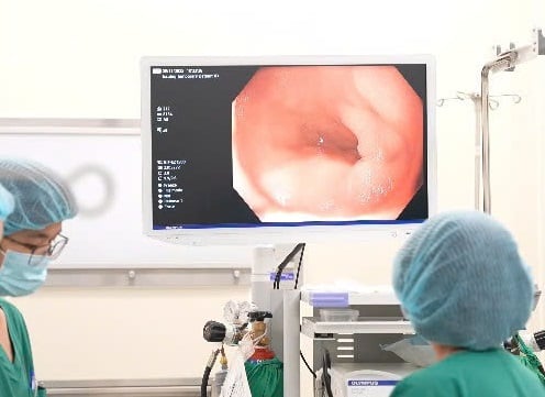 Trẻ em có nội soi tiêu hóa được không? - Ảnh 1.