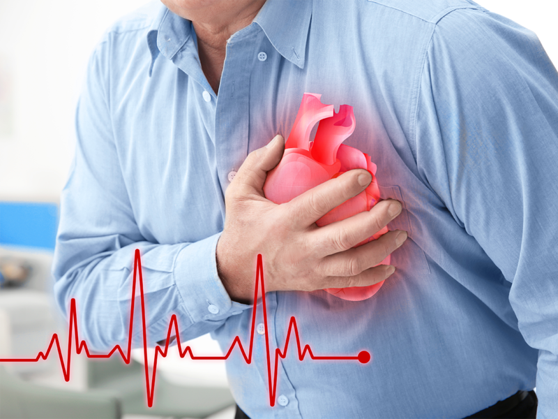 Nhận diện sớm các triệu chứng cảnh báo hẹp động mạch vành- Ảnh 2.
