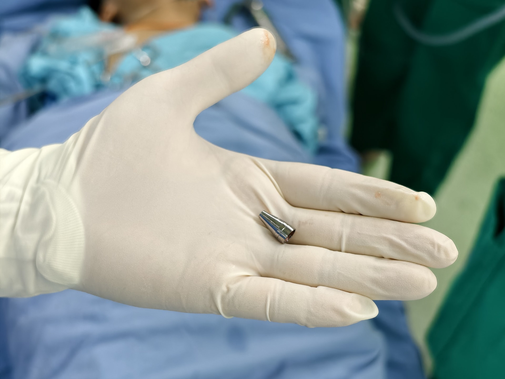 Die Spitze eines Plastikkugelschreibers, die im linken Unterlappenbronchus des Kindes feststeckte, wurde von Ärzten mithilfe eines Endoskops entfernt. Foto: L.H.