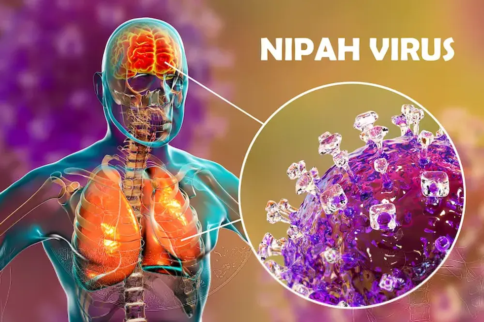 Wat je moet weten over het dodelijke Nipah-virus.
