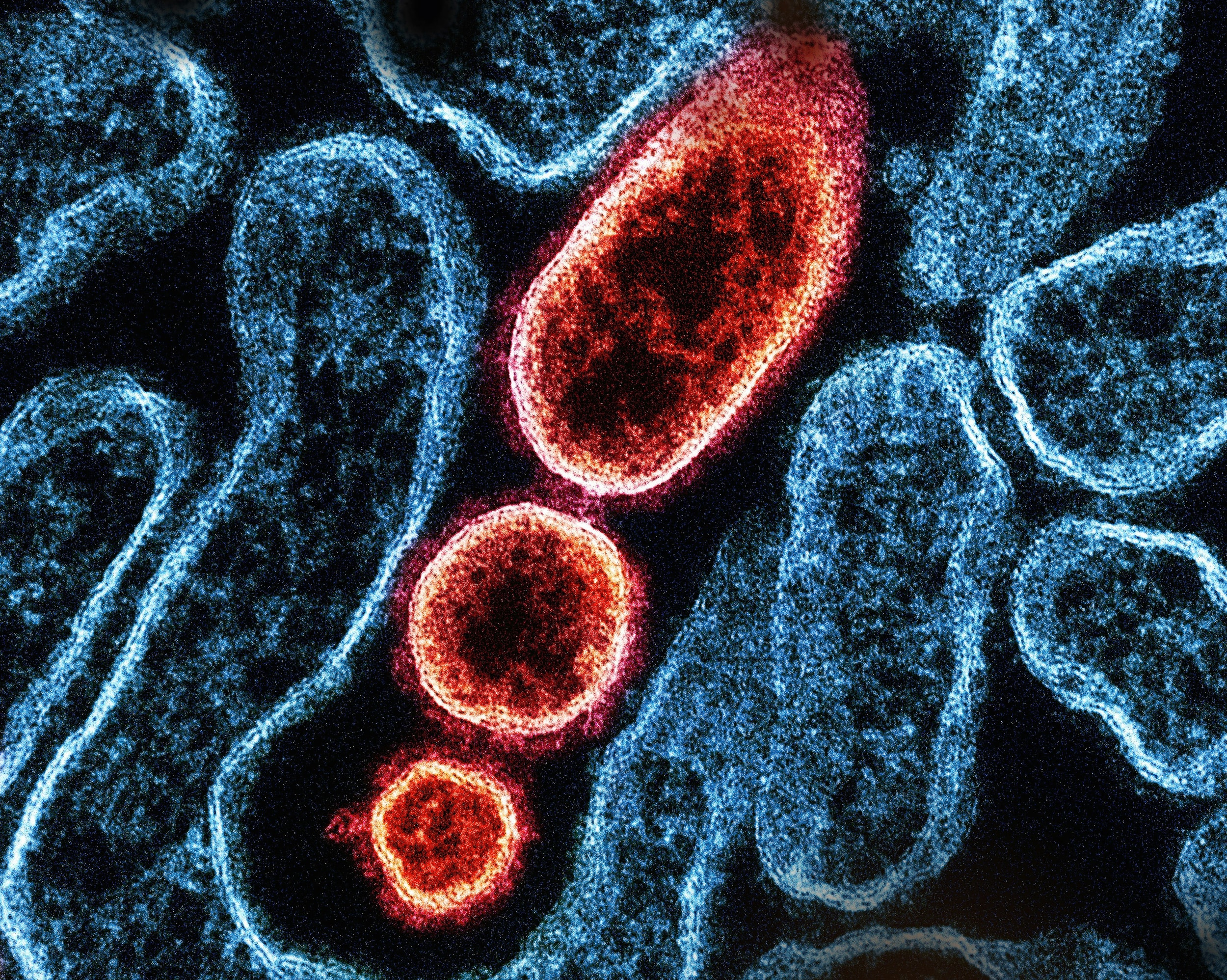 Hình ảnh cận cảnh một tế bào máu với các tế bào hồng cầu.