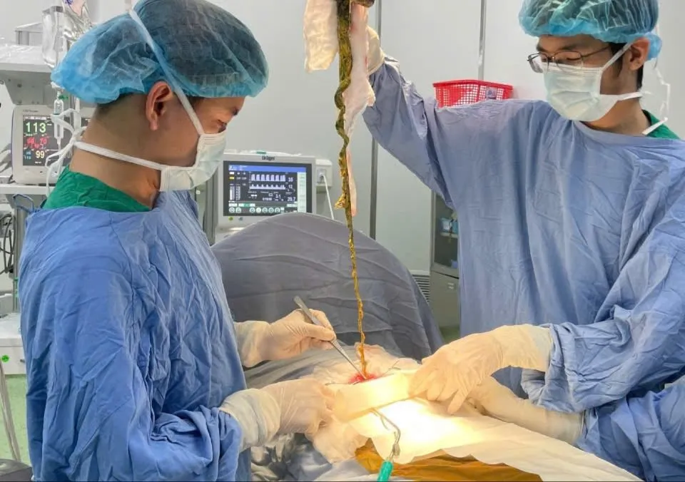 Rimuovere la ciocca di capelli dal corpo del bambino.