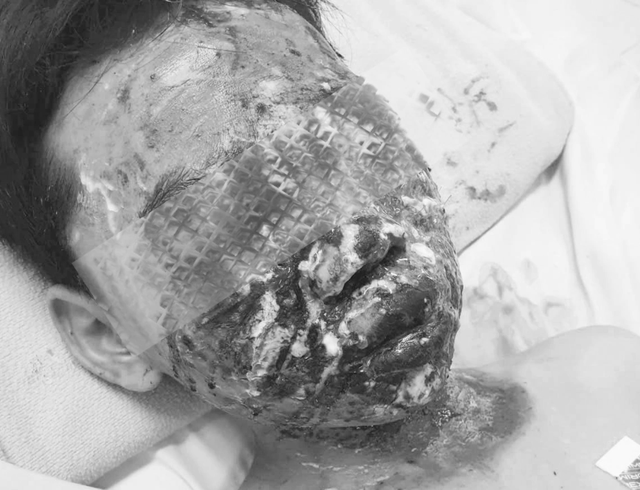 Bác sĩ cảnh báo hóc dị vật, tai nạn pháo nổ dịp cận Tết - Ảnh 2.