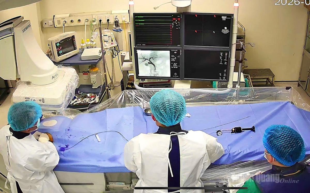 Modern medical equipment was used to perform the intervention.