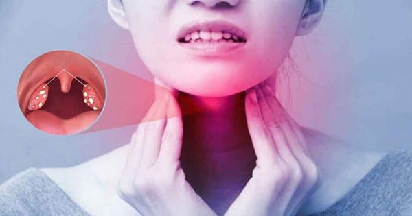 再発する扁桃炎は手術で治療すべきでしょうか?