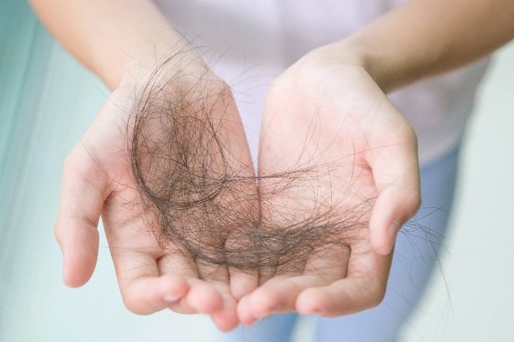 Rụng tóc như thế nào mới đáng lo ?- Ảnh 1.