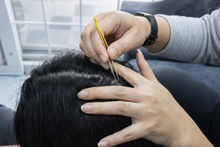 Strappare i capelli grigi per Nhổ tóc bạc cho 'đỡ ngứa mắt', coi chừng tóc không mọc lại - Ảnh 1.