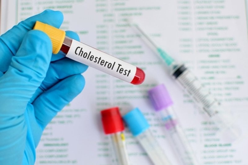 5 cập nhật mới về quản lý cholesterol không cần dùng thuốc- Ảnh 1.