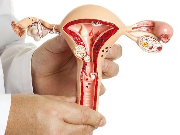 Vì sao nhân xơ tử cung khiến phụ nữ khó có thai?- Ảnh 1.
