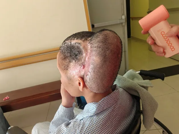 Pacient byl nyní propuštěn z nemocnice, žije stabilním životem a postupně se vrací do normálního života.