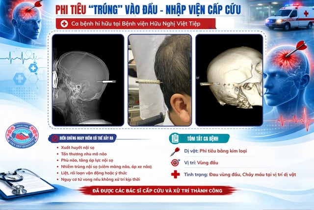ຜູ້ຊາຍຖືກນຳສົ່ງໂຮງໝໍຫຼັງຈາກຖືກລູກດາບຕີທີ່ຫົວ - ຮູບທີ 1. Người đàn ông bị phi tiêu cắm trúng đầu nhập viện khẩn cấp- Ảnh 1.