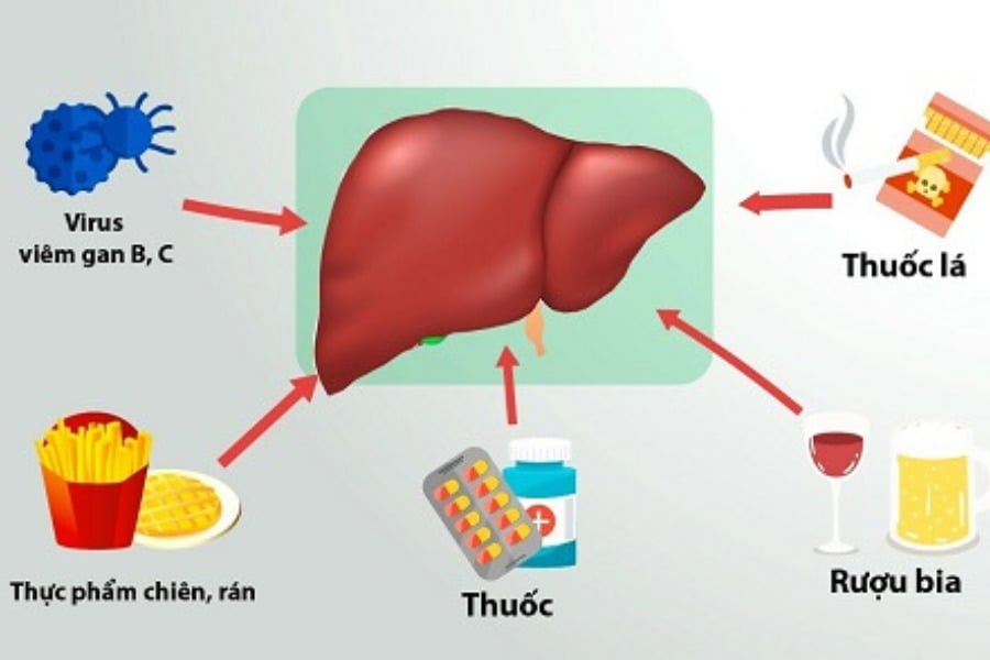 Quale tipo di dieta può abbassare naturalmente gli enzimi epatici? - Immagine 2.