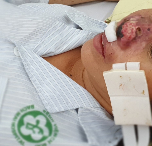 Bệnh 'sốt đất' dễ bị chẩn đoán nhầm và diễn biến nặng - Ảnh 1.