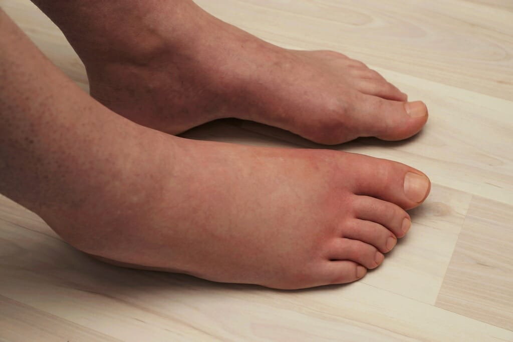 5 dấu hiệu 