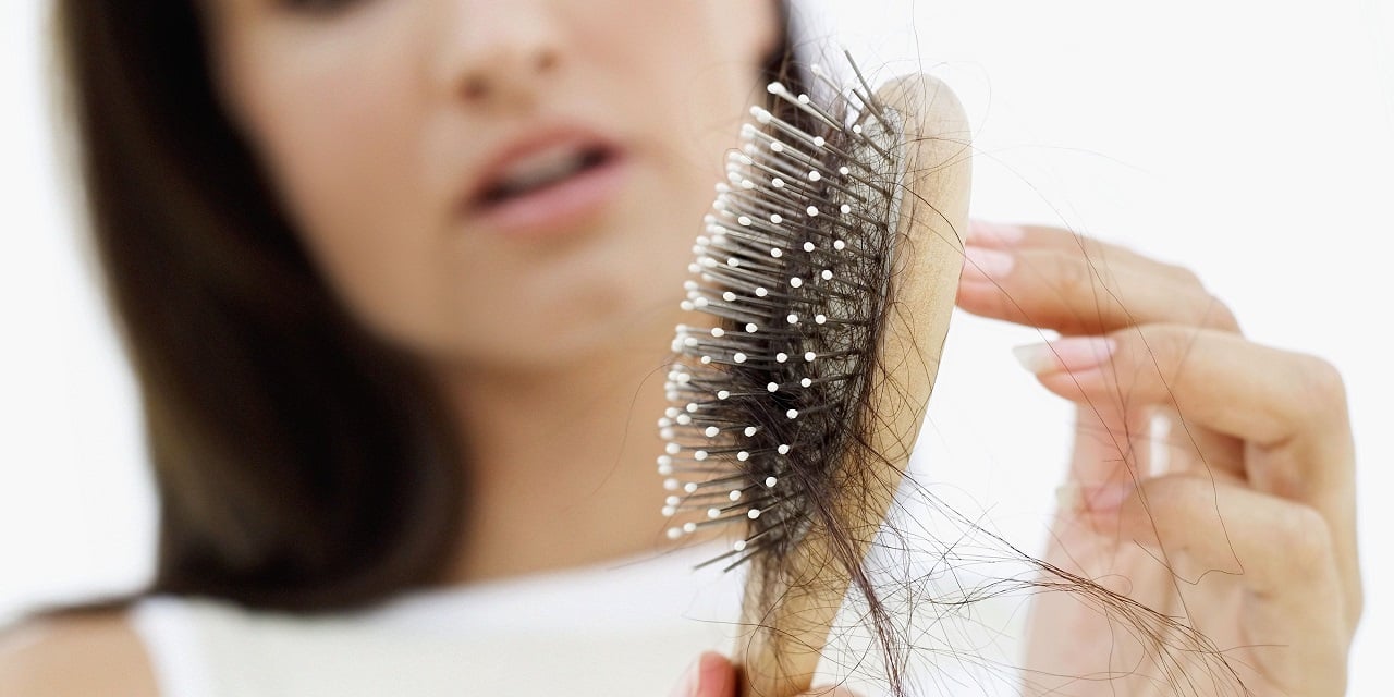 آیا کم خونی میتواند باعث ریزش مو شود؟ - تصویر 1. Thiếu máu có gây rụng tóc không?- Ảnh 1.
