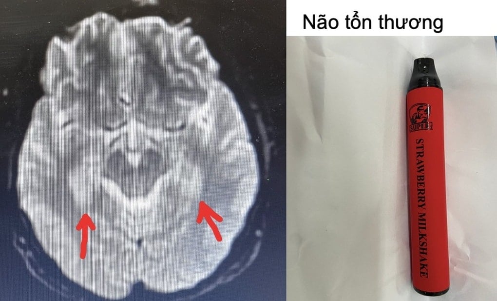 Bộ Y tế đề xuất cấm người sinh sau năm 2010 hút thuốc lá - 1