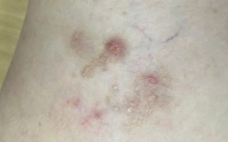 عکس: BVCC Ảnh: BVCC