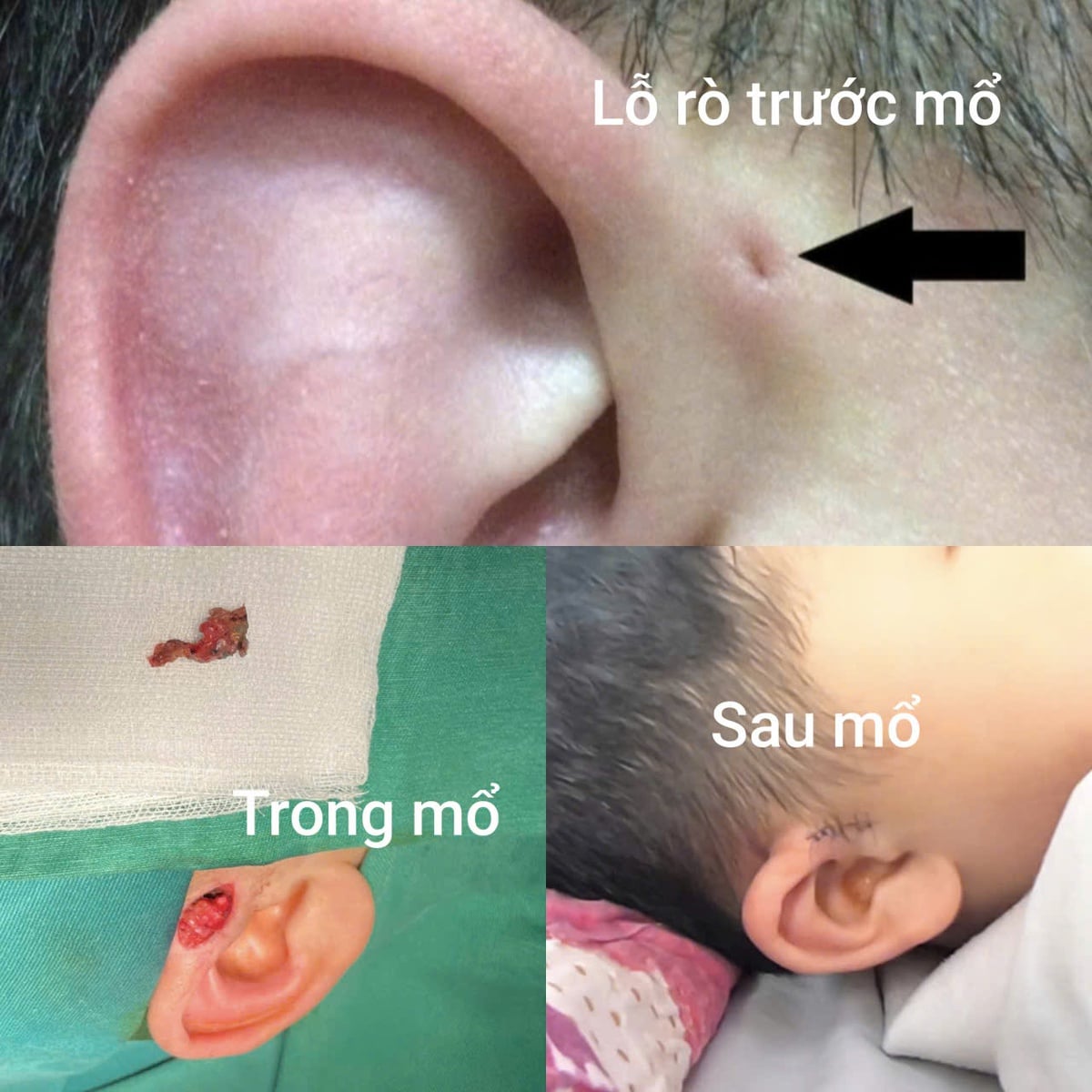 Hy hữu gia đình 3 thế hệ cùng mắc dị tật- Ảnh 1.