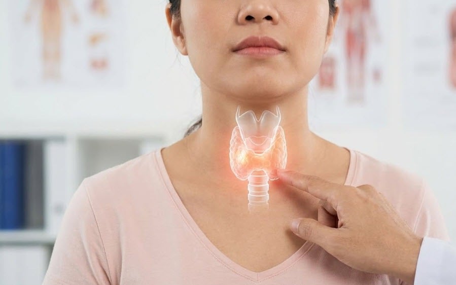 Khi nào người bệnh tuyến giáp cần thay đổi chế độ ăn?- Ảnh 2. Sau cắt tuyến giáp, vì sao nguy cơ loãng xương tăng cao?
