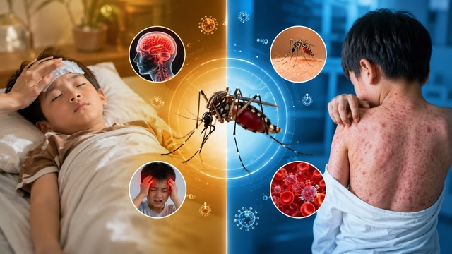Nepodceňujte letní horečky - Foto 1. Đừng xem nhẹ những cơn sốt mùa hè- Ảnh 1.