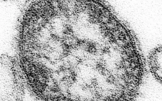 Virus sởi dưới kính hiển vi điện tử. (Ảnh: CDC/Kyodo)