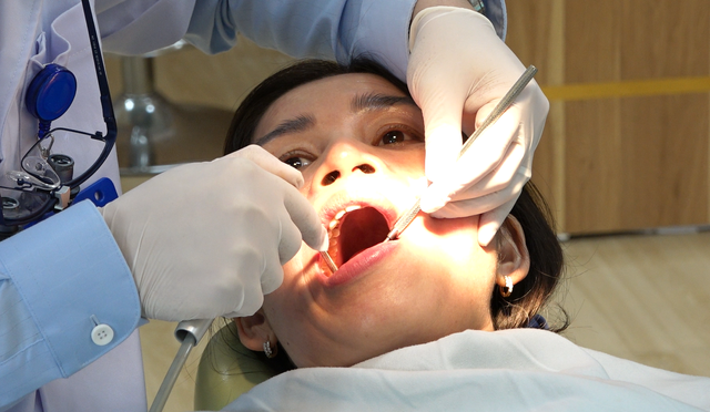 Có cần phải lấy cao răng thường xuyên? - Ảnh 2.
