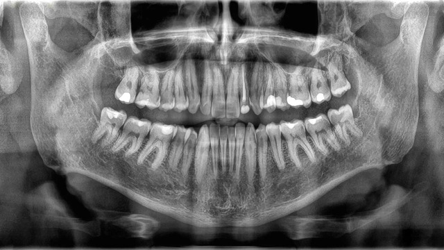 Răng có được xem là xương không?- Ảnh 1.