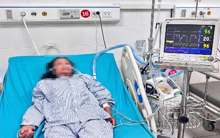 Bệnh nhân nhập viện trong tình trạng suy hô hấp phải thở máy. Ảnh: Bệnh viện Đa khoa Hòa Bình 