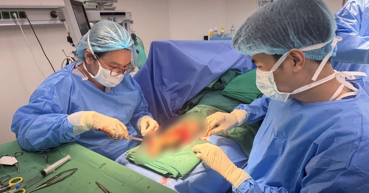 Teknik Cangkok Kulit Kepala Selamatkan Kaki Gadis 21 Tahun Pasca Kecelakaan Parah