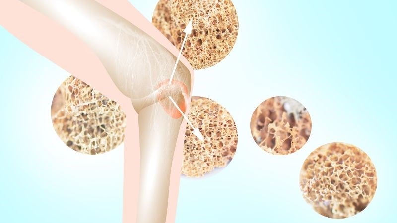 7 cách tăng cường và duy trì mật độ xương ở mọi lứa tuổi- Ảnh 1.